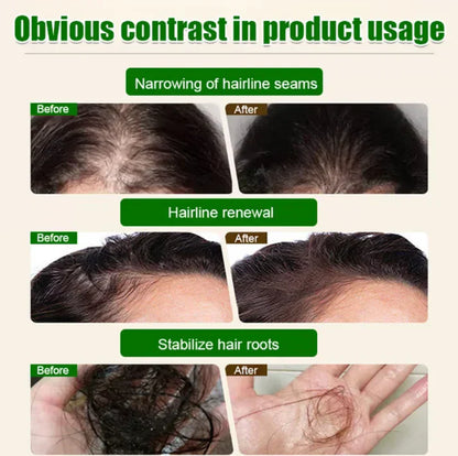 🖤2026 New Year · 30% OFF🖤Pure Batana Oil for Hair Growth